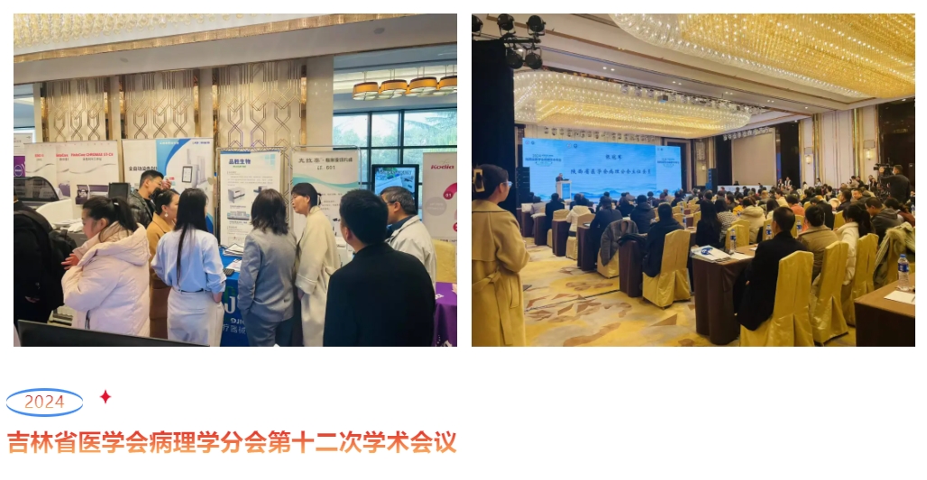 JBO��Ѷ����