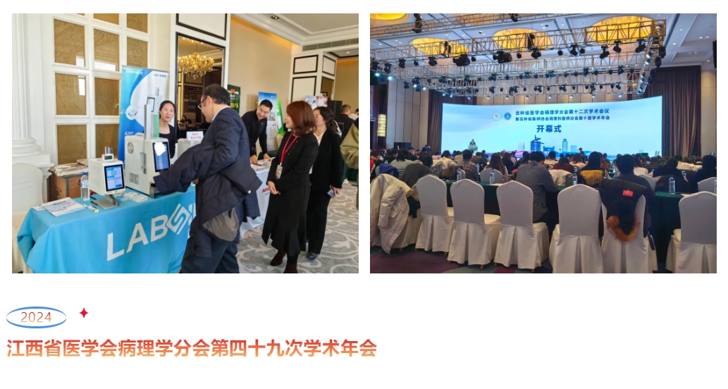 JBO��Ѷ����