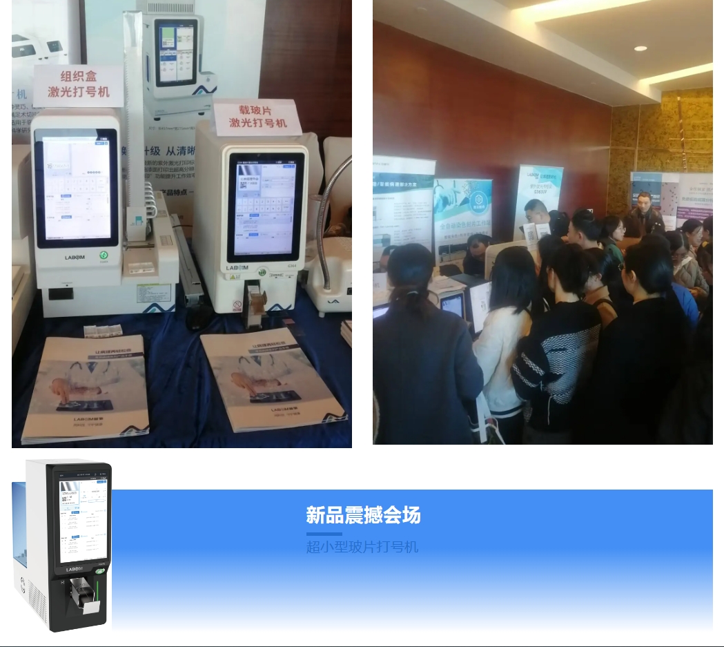 JBO��Ѷ����