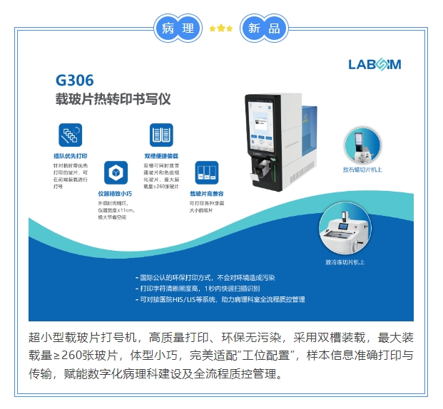 JBO��Ѷ����